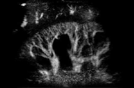 Tomowave – Maestro