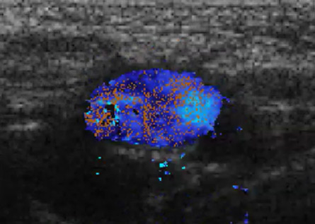 Tomowave – Maestro