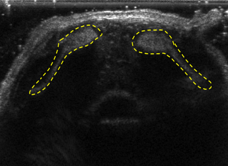 Tomowave – Maestro