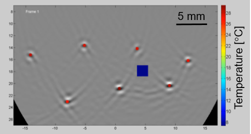 Tomowave – Optoacoustic Temperature Imaging